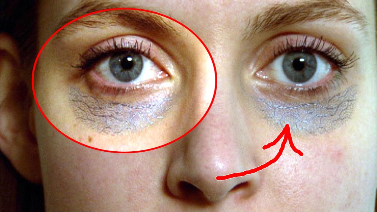 Темные круги под глазами женщин лечение. Пигментация вокруг глаз. Коричневая кожа вокруг глаз.