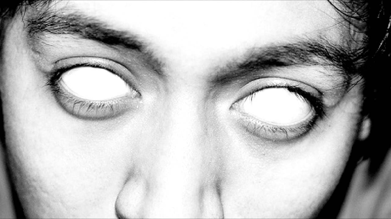 Трудно открыть глаза. Белые глаза у человека без зрачков. Глаз человека.