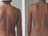 ... является характерной анатомической особенностью мужской и женской спины.