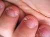 Привычка грызть ногти