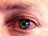Для начала – выясним, каковы причины появления красных глаз и как можно ...