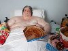 Самый толстый человек в мире: я думал о самоубийстве