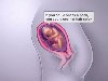 Fetal Development at 25 weeks illustration