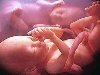 Ребенок распознает речь уже в материнской утробе В период внутриутробного ...