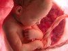 Новосибирские врачи впервые прооперировали ребенка в утробе матери ...