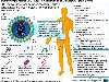 ВИЧ-инфекция — заболевание, вызываемое ретровирусом, приводящее к ...