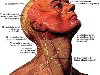 Области распространения кожных нервов головы и шеи; ...