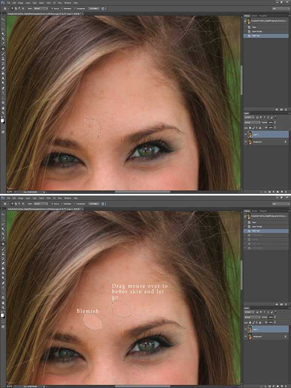 Как убрать дефекты кожи в фотошопе